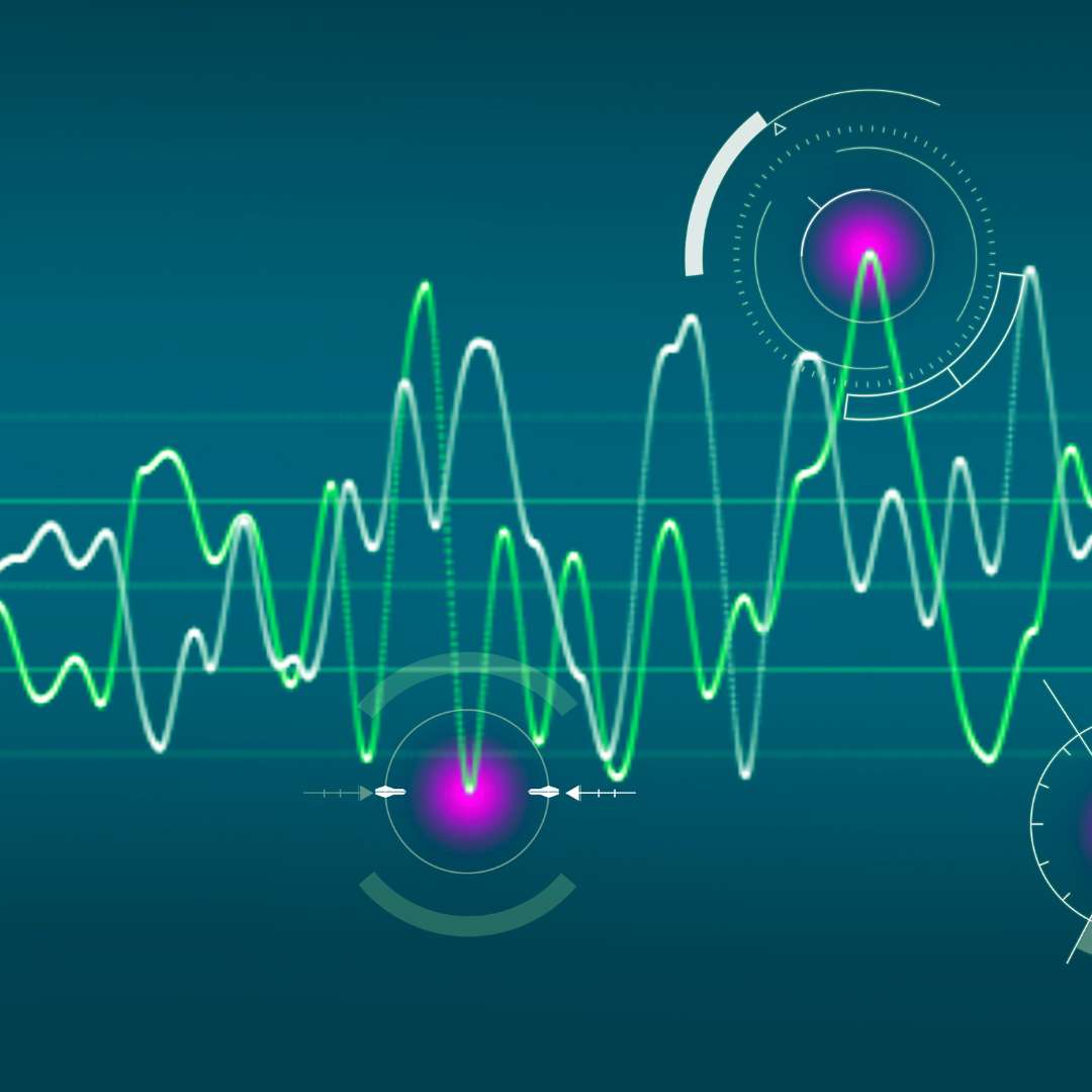 radio frequency